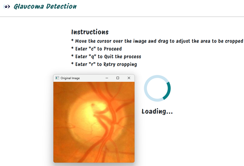 GlaucomaDetection preview