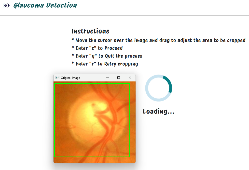 GlaucomaDetection preview